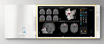 Imagen: El centro de Información quirúrgica Buzz Digital OR (Fotografía cortesía de Brainlab).